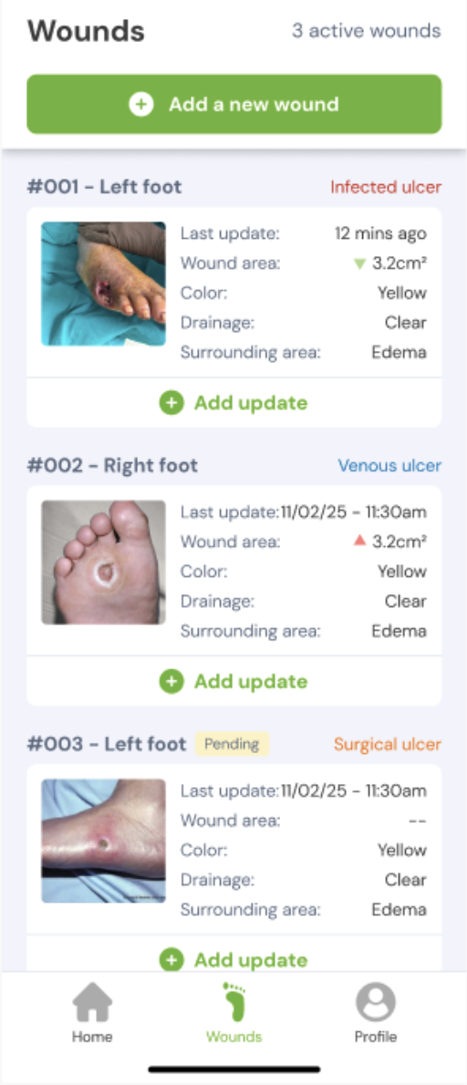 Add New Wound from Mobile App