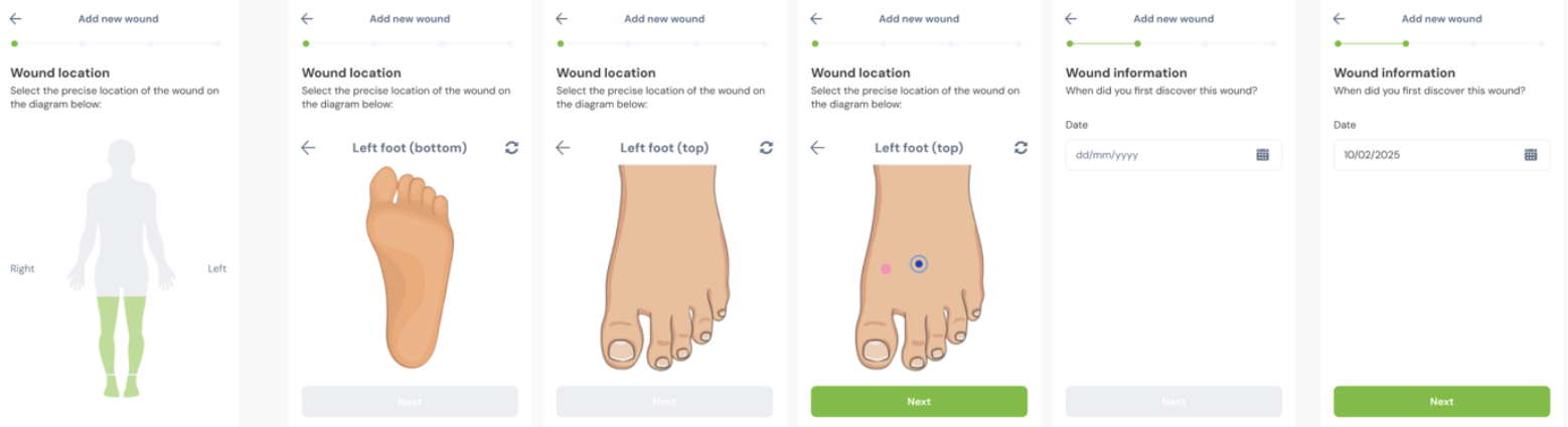 Add Wound Flow - Mobile