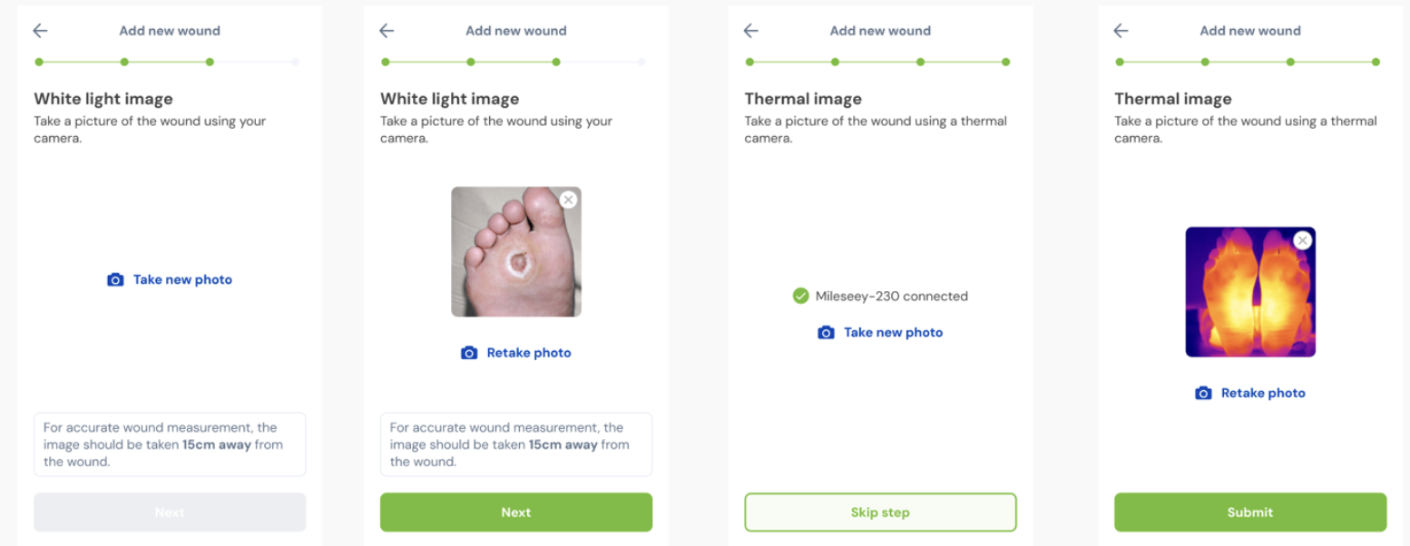Add Update Flow - Mobile