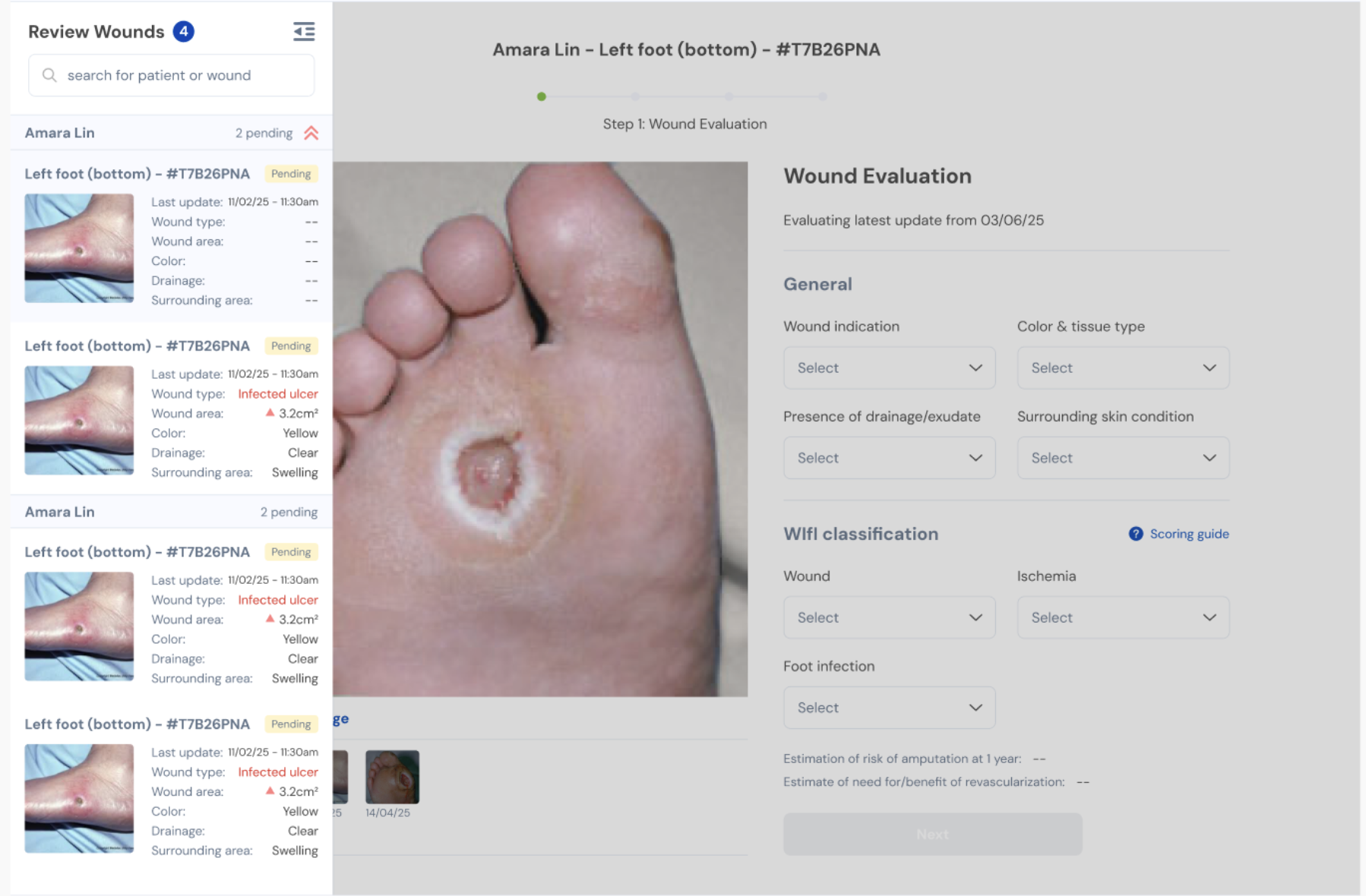 Review Wound Page